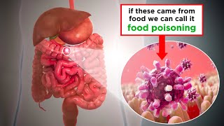 Food Poisoning Shiga ToxinProducing E coli [upl. by Eniamraj]