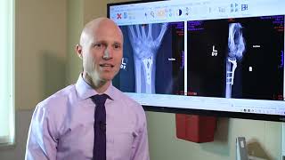 Broken Wrists Fracture Types Treatment Options amp Recovery  Dr Froelich [upl. by Alford]