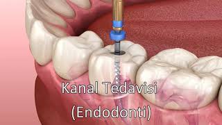 Kanal Tedavisi  Endodonti [upl. by Esnahc618]