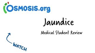 Jaundice  Clinical Presentation [upl. by Hembree236]