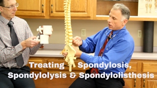 Treating Spondylosis Spondylolysis amp Spondylolisthesis Lumbar Spine [upl. by Rebekah]