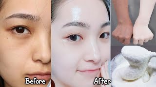 Japanese secret to whitening skin and get rid of pigmentation to get a fresh complexion [upl. by Aimac]