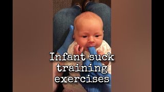 Infant Suck Training Exercises [upl. by Darian]