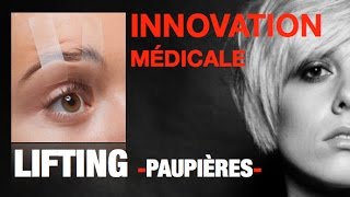 LIFTING DES PAUPIÈRES sans cicatrice  PlexR® en vidéo avantaprès [upl. by Hufnagel395]