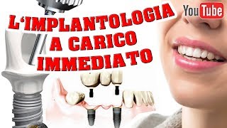 Implantologia A Carico Immediato [upl. by Wilden230]