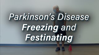 Parkinsons Disease Freezing amp Festinating Gait [upl. by Anaila]