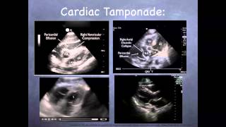 Understanding Fetal Circulation [upl. by Engud251]