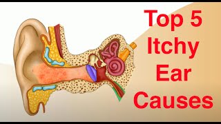 Top 5 Causes of Itchy Ears and Treatment Too [upl. by Teyugn821]