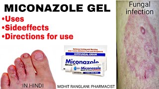 Miconazole nitrate cream  Uses sideeffects directions  Fungal infection treatment in Hindi [upl. by Orgell]