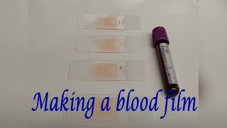 Making a blood film [upl. by Radie]