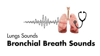 Chronic bronchitis pathophysiology  Respiratory system diseases  NCLEXRN  Khan Academy [upl. by Baggott]