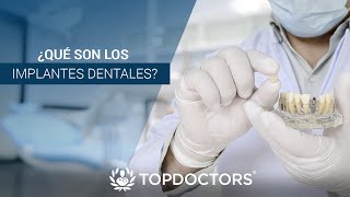 ¿Qué son los implantes dentales [upl. by Zirtaeb]