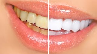 Comment blanchir ses dents naturellement  Oil pulling [upl. by Aivad428]