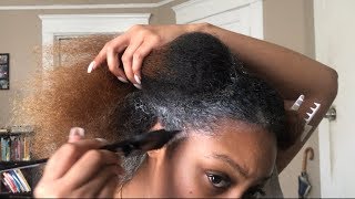 Grow Back HAIR AND EDGES FAST  Monistat 7 Scalp Treatment for Hair Growth [upl. by Alakim]