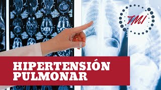 Hipertensión Pulmonar [upl. by Cosme]