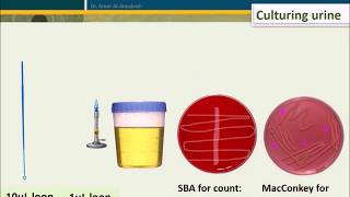 Urine Culture How To Interpret Count [upl. by Omocaig]