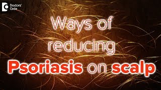 What helps psoriasis on scalp  Dr Rasya Dixit [upl. by Aicekat]