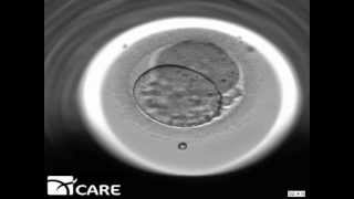 Time Lapse Embryo Imaging [upl. by Dempstor]