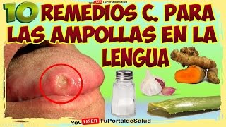 10 Remedios Caseros para las Ampollas en la Lengua [upl. by Oam]