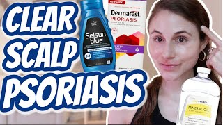 How to CLEAR SCALP PSORIASIS Dr Dray [upl. by Eigroeg474]