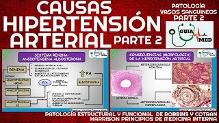 SINTOMAS DE HIPERTENSIÓN ARTERIAL FISIOPATOLOGÍA PARTE 2  GuiaMed [upl. by Dehlia185]