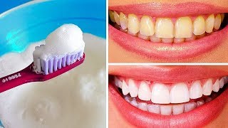 10 Des Meilleurs Moyens Pour Naturellement Blanchir Tes Dents à la Maison [upl. by Ecal]