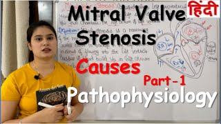 Mitral Valve Stenosis in Hindi  Definition  Causes Pathophysiology  Part1 [upl. by Anaeda942]