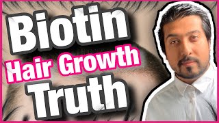 Biotin Hair Growth Truth Revealed  Is Biotin Good for Hair Growth 💇‍♂️ [upl. by Ezalb18]