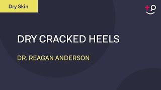 Get Rid of Your Dry Cracked Heels  Dermatologist Tips For Treatment [upl. by Gninnahc]