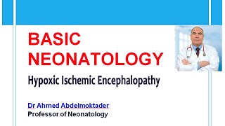 ABO incompatbility Rh hemolysis Part 3  Hyperbilirubinemia Tala Talks NICU [upl. by Augustin]