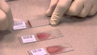 IDEXX  How to make a Blood Film in 3 steps [upl. by Neelrac508]