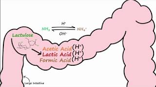 Hepatic Encephalopathy and Lactulose [upl. by Alfred]