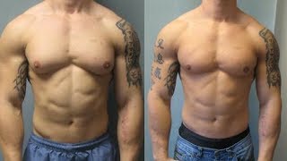 gynecomastia workout routine [upl. by Asiilanna]