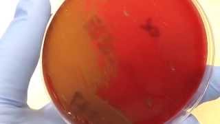 Microbiology  Hemolysis [upl. by Mukul]