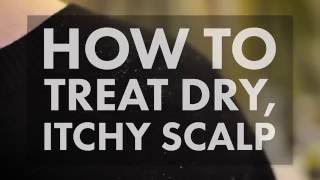 How to Treat a Dry Itchy Scalp  WebMD [upl. by Ruel239]