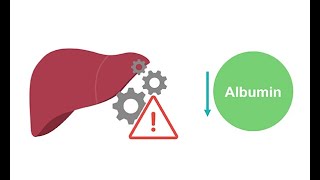 Getting to know albumin physiology [upl. by Skolnik]