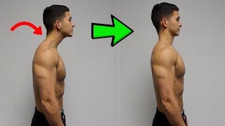 FIX Forward Head Posture Daily Corrective Routine [upl. by Rehpotsirhcnhoj173]