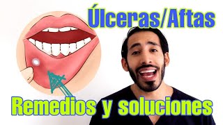 Llagas en la boca  úlceras en la boca REMEDIOS CASEROS EFECTIVOS [upl. by Yrram]