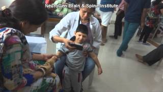 Treatment for Spastic Quadriplegia Cerebral Palsy [upl. by Nanine]